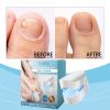 EOHOE Nail Care, Nail Cleaning Care To Discomfort On The Foot Of The Nail Smooth Rough Surface Of The Nail